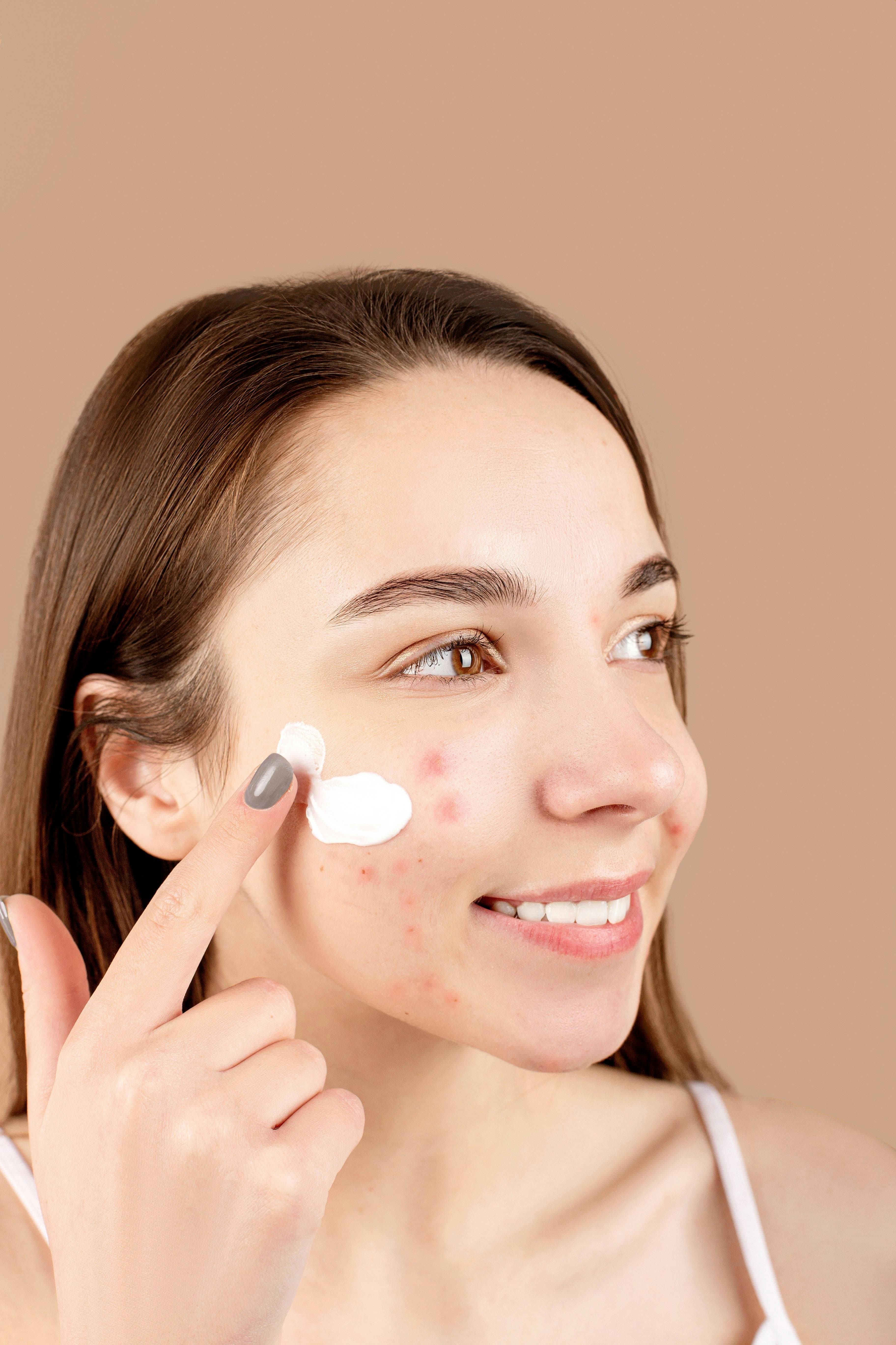 Tratamento para acne — benefício 3