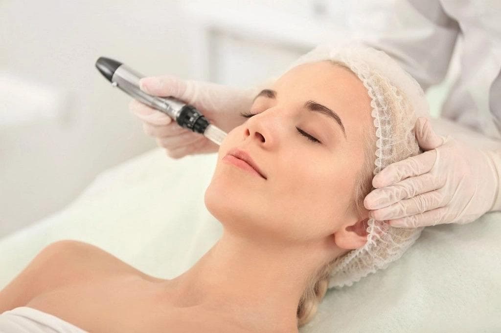 Rejuvenescimento facial — região tratada, imagem 2